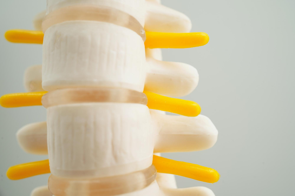 Degenerative Disc Disease Los Angeles, CA , S. Pasadena, CA