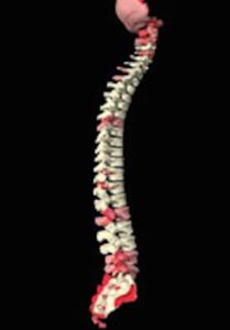 Spinal curve illustration of neck and lower back